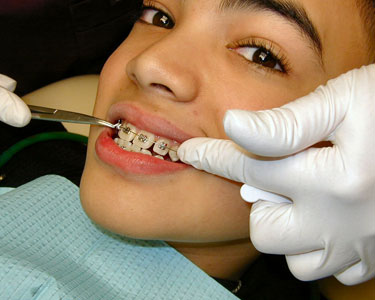 Kids Seminole County: Orthodontists - Fun 4 Seminole Kids